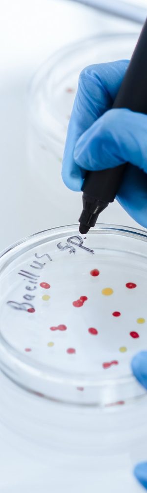 close-up-scientist-marking-petri-dish-with-viral-bacteria-science-health